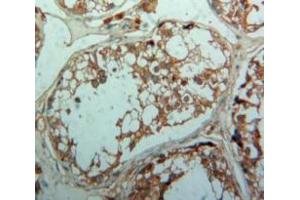Used in DAB staining on fromalin fixed paraffin-embedded Testis tissue (TGFBR1 anticorps  (AA 162-403))