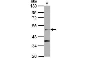 WB Image Sample (30 ug of whole cell lysate) A: NT2D1 10% SDS PAGE antibody diluted at 1:500 (NR6A1 anticorps  (C-Term))