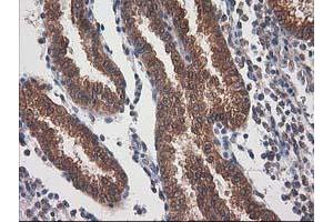 Image no. 10 for anti-Destrin (Actin Depolymerizing Factor) (DSTN) antibody (ABIN1497907)