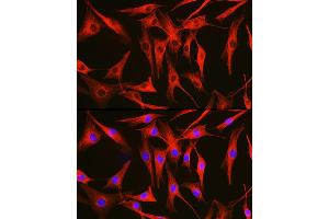 Immunofluorescence analysis of NIH/3T3 cells using Alpha-tubulin (ubiquitous) chain antibody (ABIN7271033) at dilution of 1:100. (TUBA1B anticorps  (AA 1-451))