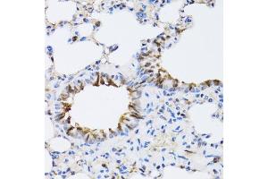 Immunohistochemistry of paraffin-embedded rat lung using N antibody (ABIN6129932, ABIN6144318, ABIN6144319 and ABIN6222781) at dilution of 1:100 (40x lens).