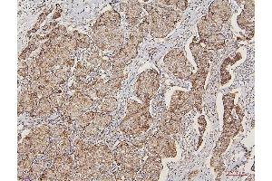 IHC analysis of LPP using anti-LPP antibody (ABIN7599606).