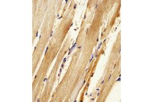 (ABIN6242157 and ABIN6578316) staining Zebrafish ak2 in zebra fish body tissue sections by Immunohistochemistry (IHC-P - paraformaldehyde-fixed, paraffin-embedded sections). (Adenylate Kinase 2 anticorps  (N-Term))