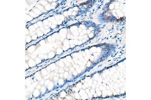 Immunohistochemistry of paraffin-embedded Human liver (negative control sample) using Y antibody (ABIN7271418) at dilution of 1:1000 (40x lens).