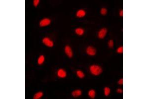 Immunofluorescent analysis of ELK1 staining in NIH3T3 cells. (ELK1 anticorps  (N-Term))
