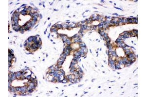 Immunohistochemistry (Paraffin-embedded Sections) (IHC (p)) image for anti-Cell Division Cycle 6 Homolog (S. Cerevisiae) (CDC6) (AA 147-549) antibody (ABIN3043500)