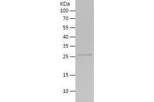 Western Blotting (WB) image for Synovial Sarcoma Translocation Gene On Chromosome 18-Like 1 (SS18L1) (AA 282-396) protein (His tag) (ABIN7125285)