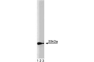 Western blot analysis of ARF-3 on a rat cerebrum lysate. (ARF3 anticorps  (AA 1-181))