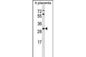 STARD4 Antibody (N-term) (ABIN656728 and ABIN2845952) western blot analysis in human placenta tissue lysates (35 μg/lane). (STARD4 anticorps  (N-Term))