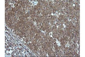 Image no. 4 for anti-Mitogen-Activated Protein Kinase Kinase 1 (MAP2K1) antibody (ABIN1499381)