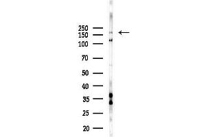 Western blot analysis of lysates from HepG2 cells(LPS, 4h treatment), using ZNF262 Antibody at 1/1000 dilution.