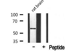 Western blot analysis of Cytochrome P450 1A2 Antibody expression in rat brain tissue lysates. (CYP1A2 anticorps  (Internal Region))
