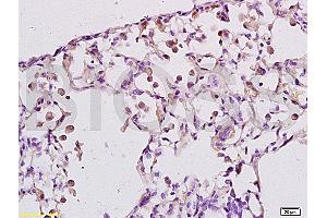 Formalin-fixed and paraffin embedded rat lung labeled with Anti-LTB4-R1/BLTR Polyclonal Antibody, Unconjugated (ABIN748628) at 1:200 followed by conjugation to the secondary antibody and DAB staining.