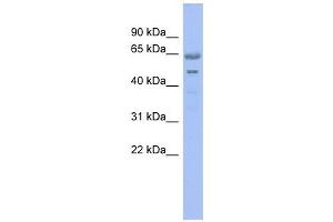 GNL3 antibody used at 1 ug/ml to detect target protein. (Nucleostemin anticorps)