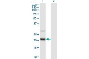 Western Blot analysis of RAX2 expression in transfected 293T cell line by RAX2 MaxPab polyclonal antibody. (RAX2 anticorps  (AA 1-184))