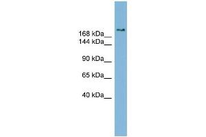 WB Suggested Anti-SETBP1 Antibody Titration:  0. (SETBP1 anticorps  (Middle Region))