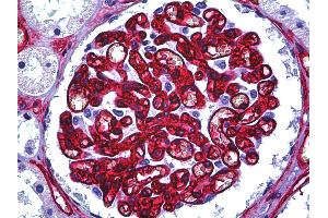 Anti-CD34 antibody IHC of human kidney, glomerulus. (CD34 anticorps)