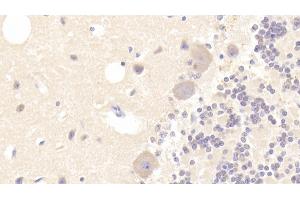Detection of TUBa3C in Human Cerebellum Tissue using Polyclonal Antibody to Tubulin Alpha 3C (TUBa3C)