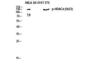 Western Blot (WB) analysis of HeLa, SH-SY5Y, 3T3 lysis using Phospho-HDAC4 (S632) antibody. (HDAC4 anticorps  (pSer632))