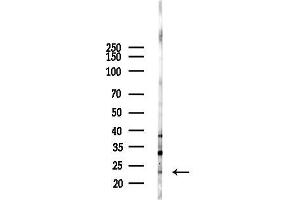 Western blot analysis of lysates from Mouse lung, using SOCS2 Antibody at 1/1000 dilution.