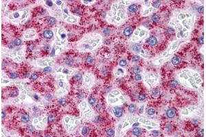 Human Liver: Formalin-Fixed, Paraffin-Embedded (FFPE) (SYPL1 anticorps  (N-Term))