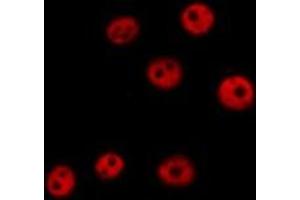 ABIN6279426 staining  HeLa cells by IF/ICC. (KHSRP anticorps  (N-Term))