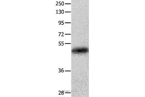 Western blot analysis of Human colon cancer tissue, using KRT23 Polyclonal Antibody at dilution of 1:100 (KRT23 anticorps)