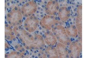 Detection of PRSS2 in Mouse Kidney Tissue using Polyclonal Antibody to Protease, Serine 2 (PRSS2)