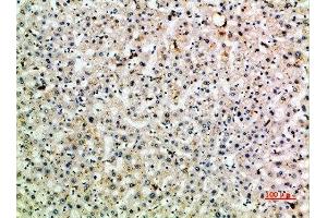 Immunohistochemical analysis of paraffin-embedded human-liver, antibody was diluted at 1:200