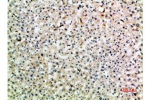 Immunohistochemical analysis of paraffin-embedded human-liver, antibody was diluted at 1:200 (C-Type Lectin Domain Family 4, Member M (CLEC4M) (AA 271-320) anticorps)