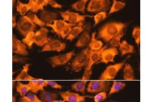 Immunofluorescence analysis of C6 cells using RPS3 Polyclonal Antibody at dilution of 1:100.
