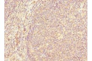 Immunohistochemistry of paraffin-embedded human tonsil tissue using ABIN7154651 at dilution of 1:100 (MCF2L anticorps  (AA 850-980))