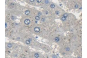 Detection of STAM2 in Human Liver Tissue using Polyclonal Antibody to Signal Transducing Adaptor Molecule 2 (STAM2)