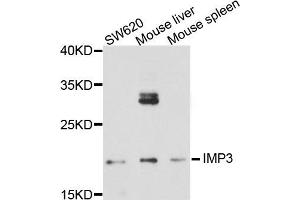 Western blot analysis of extract of various cells, using IMP3 antibody. (IMP3 anticorps)