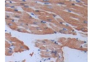 anti-Myosin, Light Chain 3 (MYL3) (AA 8-199) antibody