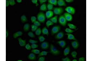Immunofluorescence staining of A549 cells with ABIN7151033 at 1:133, counter-stained with DAPI.