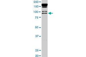 PML monoclonal antibody (M02), clone 1D12.