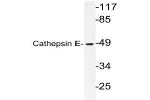 Western blot (WB) analysis of Cathepsin E antibody in extracts from HUVECcells.