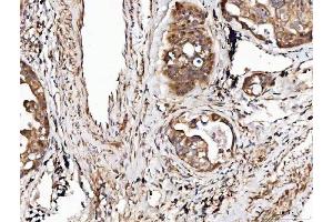 IHC analysis of Angiogenin/ANG using anti-Angiogenin/ANG antibody (ABIN4886457). (ANG anticorps  (AA 25-147))