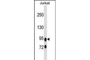 FIG4 Antibody (C-term) (ABIN1537627 and ABIN2849648) western blot analysis in Jurkat cell line lysates (35 μg/lane). (FIG4 anticorps  (C-Term))