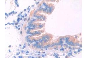 Detection of LCAT in Rat Lung Tissue using Polyclonal Antibody to Lecithin Cholesterol Acyltransferase (LCAT) (LCAT anticorps  (AA 41-210))