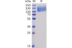 Human CEACAM5 Protein, His Tag on SDS-PAGE under reducing condition.