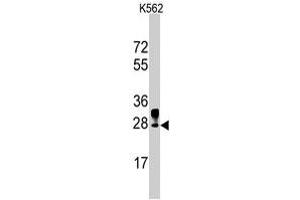 Western blot analysis of ERAS polyclonal antibody  in K-562 cell line lysates (35 ug/lane). (ERAS anticorps  (N-Term))