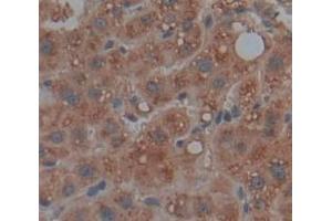 IHC-P analysis of Human Tissue, with DAB staining. (SMPD1 anticorps  (AA 319-579))
