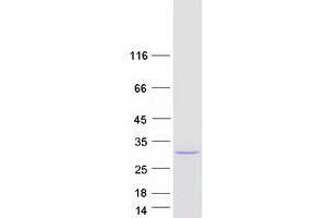 Validation with Western Blot
