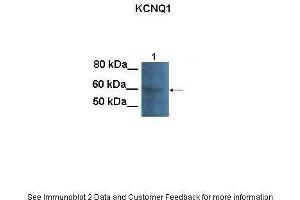 Lanes:   100 ug CHO cell lysate  Primary Antibody Dilution:   1:1000  Secondary Antibody:   Goat anti-rabbit HRP  Secondary Antibody Dilution:   1:25000  Gene Name:   KCNQ1  Submitted by:   Anonymous (KCNQ1 anticorps  (N-Term))