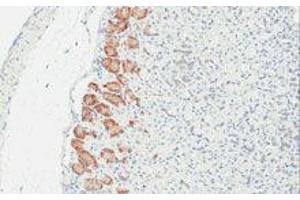 Immunohistochemistry (IHC) image for anti-TLR4 /MD2 Complex antibody (ABIN2665420) (TLR4 /MD2 Complex anticorps)
