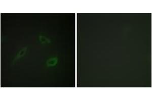 Immunofluorescence analysis of HeLa cells, using CD4 (Ab-433) Antibody. (CD4 anticorps  (AA 401-450))