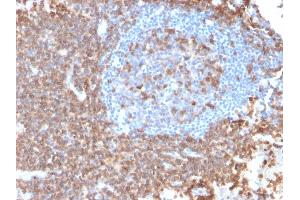 Formalin-fixed, paraffin-embedded human Lymph Node stained with CD43 Mouse Recombinant Monoclonal Antibody (rSPN/839).