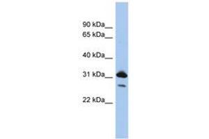 Image no. 1 for anti-RAP1B, Member of RAS Oncogene Family (RAP1B) (N-Term) antibody (ABIN6744003) (RAP1B anticorps  (N-Term))